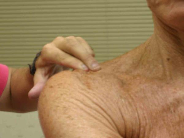 Je res, da mraz vpliva na naše sklepe?